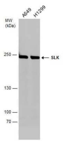 SLK Antibody, Novus Biologicals 100 &mu;g | Buy Online | Bio-Techne | Fisher Scientific