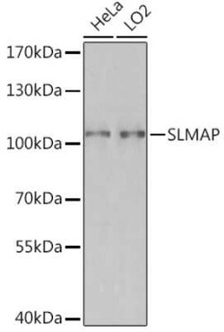 SLMAP Rabbit anti-Human, Mouse, Rat, Polyclonal, Novus Biologicals 20 &mu;g | Buy Online | Novus Biologicals | Fisher Scientific
