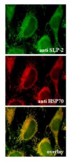 SLP-2 Antibody, Novus Biologicals 100 ug; Unconjugated:Antibodies, Polyclonal