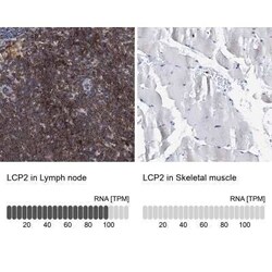 SLP-76/LCP2 Antibody, Novus Biologicals 0.1 mL | Buy Online | Novus Biologicals | Fisher Scientific