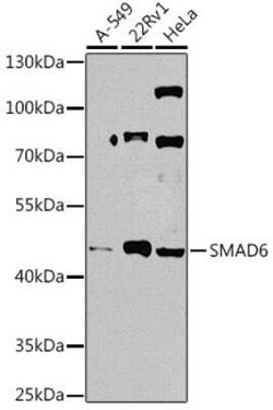 SMAD6 Antibody - BSA Free, Novus Biologicals 0.02 mL; Unconjugated:Antibodies,