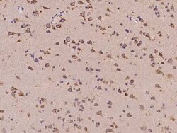 SMAP Antibody, Novus Biologicals:Antibodies:Primary Antibodies