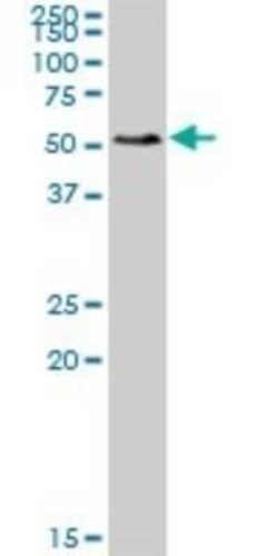 SMAP1 Antibody, Novus Biologicals 0.05 mg | Buy Online | Novus Biologicals | Fisher Scientific