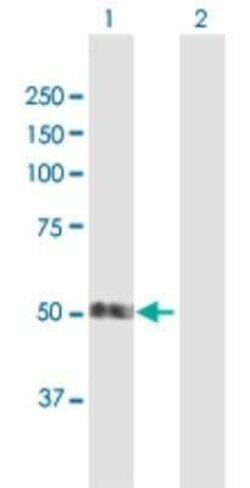 SMAP1 Antibody, Novus Biologicals 0.05 mg | Buy Online | Novus Biologicals | Fisher Scientific