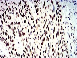SMARCA1 Antibody (2H7B9) - BSA Free, Novus Biologicals 0.1 ml; Unconjugated:Antibodies,
