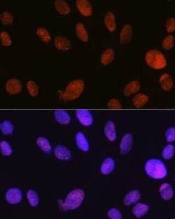 SMARCA5/SNF2H Rabbit anti-Human, Mouse, Rat, Clone: 6H8I7, Novus Biologicals 20 &mu;g | Buy Online | Novus Biologicals | Fisher Scientific