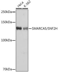 SMARCA5/SNF2H Rabbit anti-Human, Mouse, Rat, Clone: 6H8I7, Novus Biologicals 20 &mu;g | Buy Online | Novus Biologicals | Fisher Scientific
