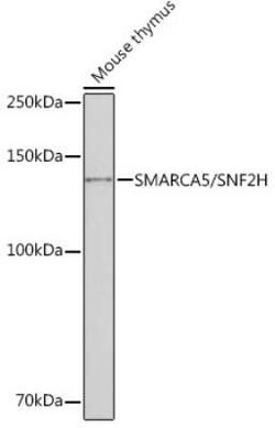 SMARCA5/SNF2H Rabbit anti-Human, Mouse, Rat, Clone: 6H8I7, Novus Biologicals 20 &mu;g | Buy Online | Novus Biologicals | Fisher Scientific