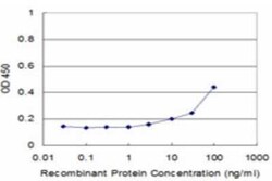 SMARCA5/SNF2H Antibody (3F4), Novus Biologicals 0.1 mg | Buy Online | Novus Biologicals | Fisher Scientific