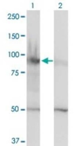 SMARCA6 Antibody (1D10), Novus Biologicals 0.1 mg | Buy Online | Novus Biologicals | Fisher Scientific