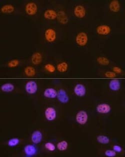 SMARCC1 Rabbit anti-Human, Mouse, Clone: 1R7I6, Novus Biologicals 100 &mu;g;