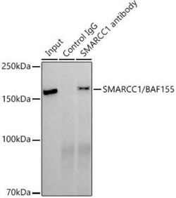 SMARCC1 Rabbit anti-Human, Mouse, Clone: 1R7I6, Novus Biologicals 100 &mu;g;