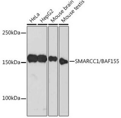 SMARCC1 Rabbit anti-Human, Mouse, Clone: 1R7I6, Novus Biologicals 100 &mu;g;