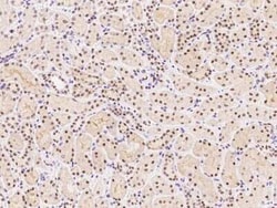 SMARCC1 Antibody, Novus Biologicals 50 &mu;g, Unconjugated:Antibodies,