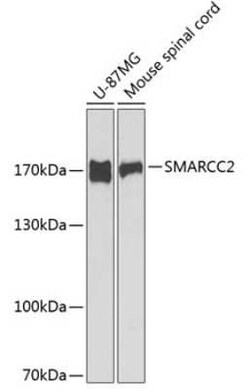 SMARCC2/BAF170 Antibody - BSA Free, Novus Biologicals:Antibodies:Primary