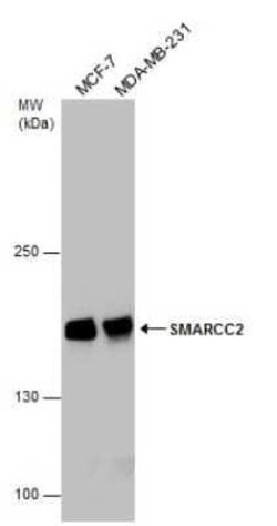 SMARCC2/BAF170 Antibody, Novus Biologicals 100 &mu;g | Buy Online | Novus Biologicals | Fisher Scientific