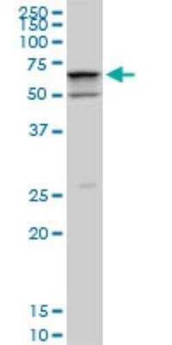 Novus Biologicals SMARCD2 Antibody (2B2), Novus Biologicals 0.1 mg | Buy Online | Novus Biologicals&trade; | Fisher Scientific