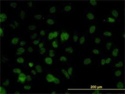 Novus Biologicals SMARCD2 Antibody (2F7), Novus Biologicals 0.1 mg | Buy Online | Novus Biologicals&trade; | Fisher Scientific