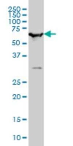 Novus Biologicals SMARCD2 Antibody (2F7), Novus Biologicals 0.1 mg | Buy Online | Novus Biologicals&trade; | Fisher Scientific
