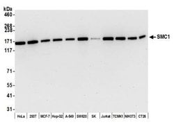 SMC1 Antibody (BL-205-2G8), Novus Biologicals 100 &mu;L | Buy Online | Novus Biologicals | Fisher Scientific