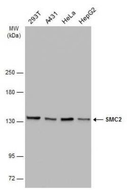 SMC2 Antibody (GT4312), Novus Biologicals 100 &mu;g | Buy Online | Bio-Techne | Fisher Scientific