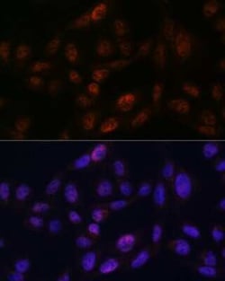 SMC3 Rabbit anti-Human, Mouse, Rat, Clone: 8W9R7, Novus Biologicals 100 &mu;g | Buy Online | Bio-Techne | Fisher Scientific
