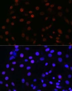 SMC3 Rabbit anti-Human, Mouse, Rat, Clone: 8W9R7, Novus Biologicals 100 &mu;g | Buy Online | Bio-Techne | Fisher Scientific