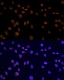 SMC3 Rabbit anti-Human, Mouse, Rat, Clone: 8W9R7, Novus Biologicals 100 &mu;g | Buy Online | Bio-Techne | Fisher Scientific