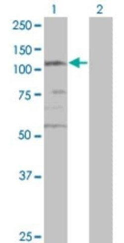 SMC3 Antibody (2F11), Novus Biologicals 0.1 mg | Buy Online | Novus Biologicals | Fisher Scientific