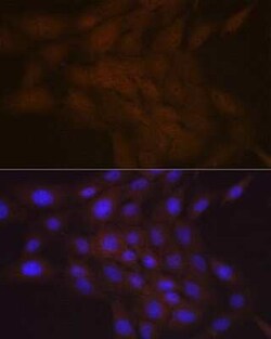 SMC4 Rabbit anti-Human, Mouse, Rat, Clone: 9Z8S3, Novus Biologicals:Antibodies:Primary