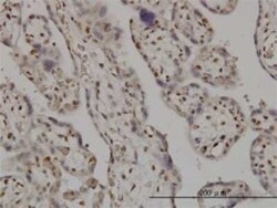 SMC6L1 Antibody (2E6), Novus Biologicals 0.1 mg | Buy Online | Novus Biologicals | Fisher Scientific