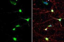 SMCR8 Antibody (HL1007), Novus Biologicals 100 &mu;g | Buy Online | Novus Biologicals | Fisher Scientific