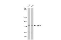 SMCR8 Antibody, Novus Biologicals 100 &mu;g; Unconjugated:Antibodies, Polyclonal