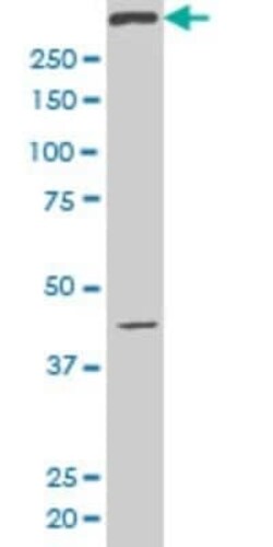 SMG1 Antibody (1A8), Novus Biologicals 0.1 mg | Buy Online | Novus Biologicals | Fisher Scientific