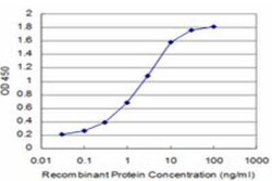 Novus Biologicals SMG1 Antibody (2B10), Novus Biologicals 0.1 mg | Buy Online | Novus Biologicals&trade; | Fisher Scientific