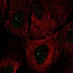 SMIM2 Rabbit anti-Human, Polyclonal, Novus Biologicals 25 &mu;g | Buy Online | Novus Biologicals | Fisher Scientific