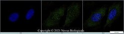 SMN Antibody (2B1) - Azide and BSA Free, Novus Biologicals 0.1 mL | Buy Online | Novus Biologicals | Fisher Scientific