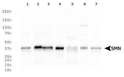 SMN Antibody (2B1) - Azide and BSA Free, Novus Biologicals 0.1 mL | Buy Online | Novus Biologicals | Fisher Scientific