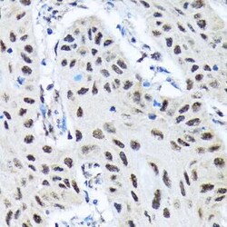 SMN Rabbit anti-Human, Rat, Clone: 9N9Q6, Novus Biologicals 20 &mu;g | Buy Online | Novus Biologicals | Fisher Scientific