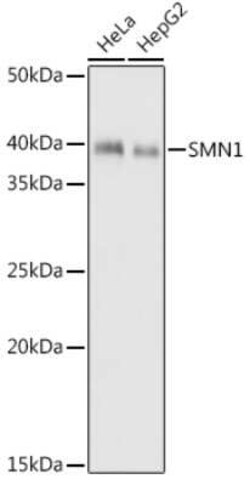 SMN Rabbit anti-Human, Rat, Clone: 9N9Q6, Novus Biologicals 20 &mu;g | Buy Online | Novus Biologicals | Fisher Scientific
