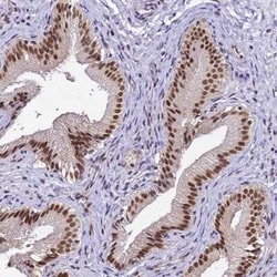 SMN Antibody, Novus Biologicals:Antibodies:Primary Antibodies