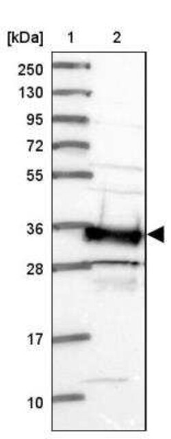 SMN Antibody, Novus Biologicals:Antibodies:Primary Antibodies