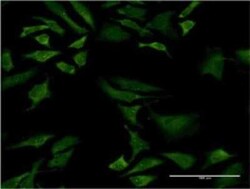 Novus Biologicals SMN2 Antibody (1A3-2B9), Novus Biologicals 0.1 mg | Buy Online | Novus Biologicals&trade; | Fisher Scientific