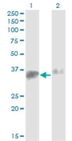 Novus Biologicals SMN2 Antibody (1A3-2B9), Novus Biologicals 0.1 mg | Buy Online | Novus Biologicals&trade; | Fisher Scientific