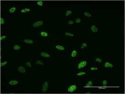 SMN2 Antibody (2B11-2A9), Novus Biologicals 0.1 mg | Buy Online | Novus Biologicals | Fisher Scientific