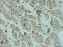 SMN2 Antibody (2B11-2A9), Novus Biologicals 0.1 mg | Buy Online | Novus Biologicals | Fisher Scientific