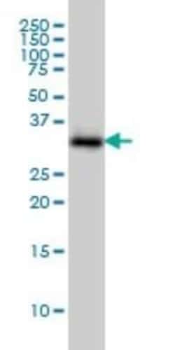 SMN2 Antibody (2B11-2A9), Novus Biologicals 0.1 mg | Buy Online | Novus Biologicals | Fisher Scientific