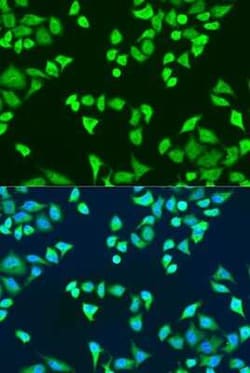 SMN2 Antibody - BSA Free, Novus Biologicals 0.02 mL; Unconjugated:Antibodies,