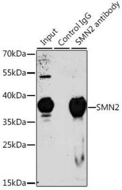 SMN2 Antibody - BSA Free, Novus Biologicals 0.1 mL; Unconjugated:Antibodies,