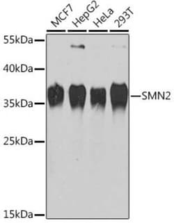 SMN2 Antibody - BSA Free, Novus Biologicals 0.1 mL; Unconjugated:Antibodies,